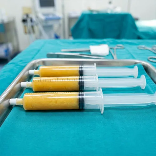 Xử lý mỡ