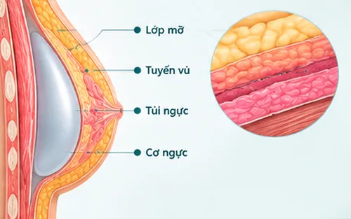 Độ dày mô mềm