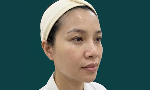 Sau