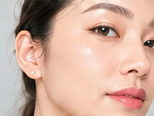 Cấy HA vùng mặt