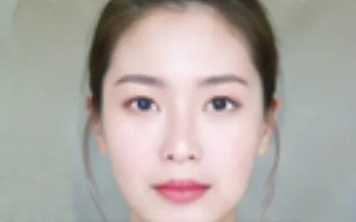 Cấy mỡ mặt