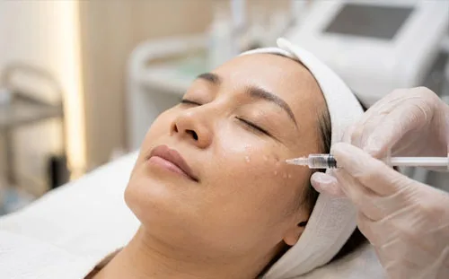 Cấy tinh chất xóa nhăn