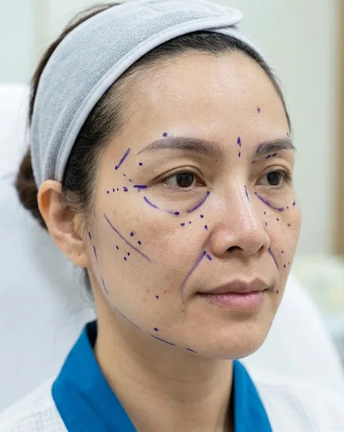 Trước