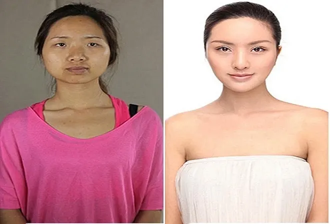 Phụ nữ Trung Quốc đổ sang Hàn Quốc phẫu thuật thẩm mỹ