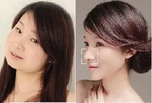 Phụ nữ Trung Quốc đổ sang Hàn Quốc phẫu thuật thẩm mỹ