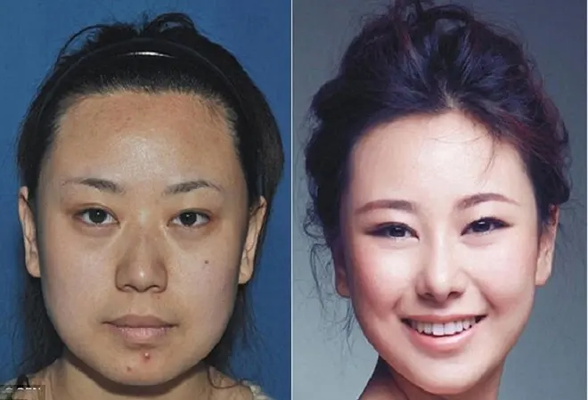 Phụ nữ Trung Quốc đổ sang Hàn Quốc phẫu thuật thẩm mỹ