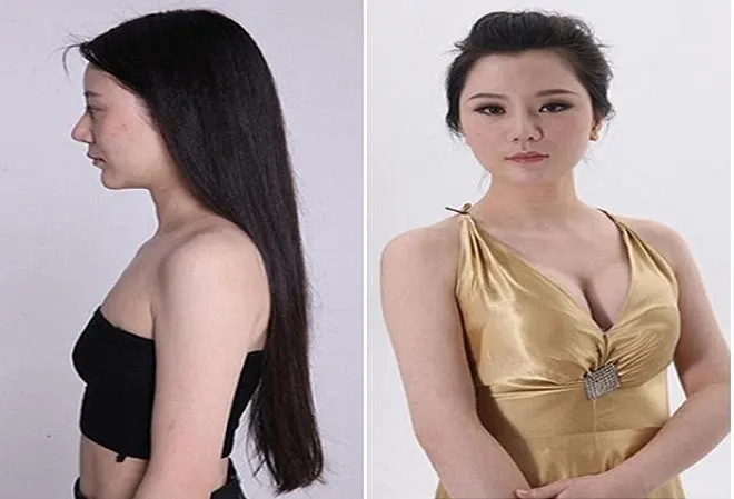 Phụ nữ Trung Quốc đổ sang Hàn Quốc phẫu thuật thẩm mỹ